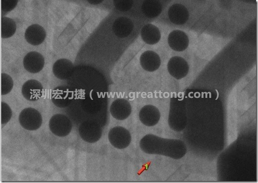 BGA因?yàn)楹笁|變小，造成錫膏過多而最終形成焊接短路的結(jié)果。